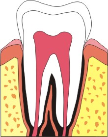 dente dentisti bassano