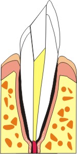 endodonzia dentisti
