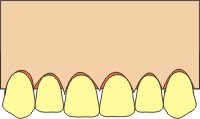 Parodontologia dentale