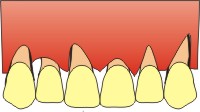 Parodontologia dentisti