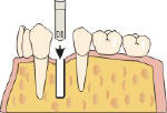 implantologia dentista