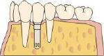 impianto dentisti