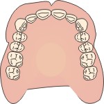 metallo ceramica dentisti bassano